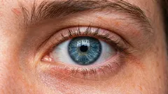 Kako podići spuštene kapke? 3 glavna uzroka i metode korekcije