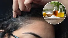 Koje su prednosti korištenja octa i sode bikarbone za uklanjanje sijede kose i kako to pravilno učiniti?